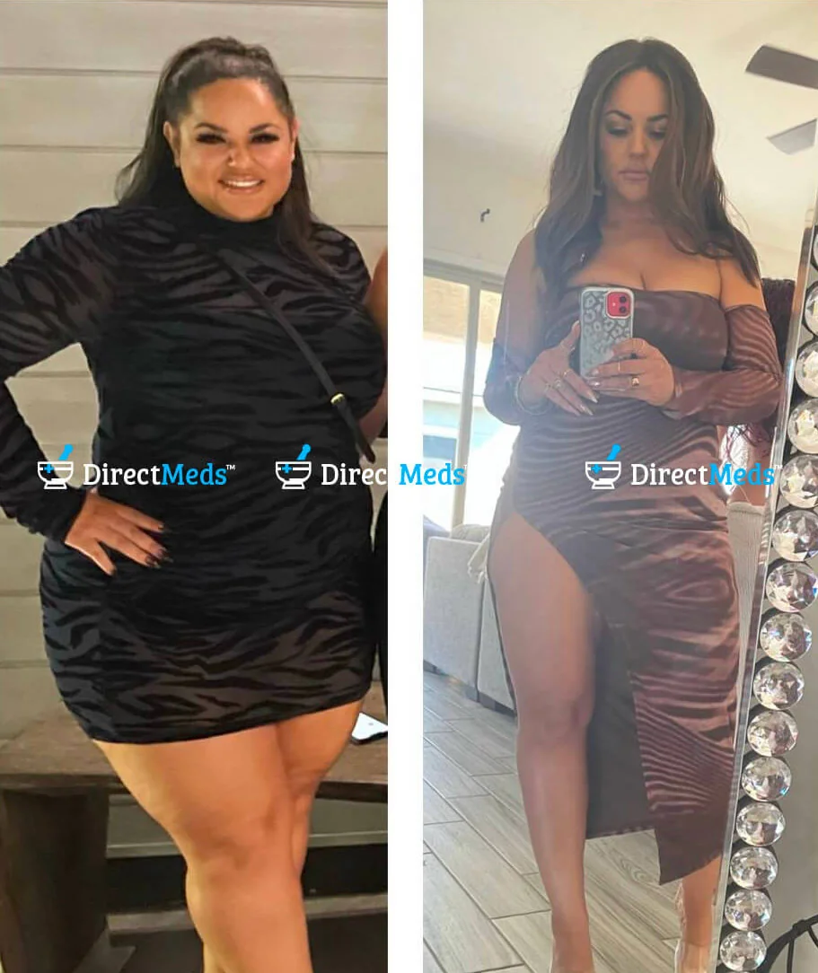 Leilani, before and after photos from her weight-loss program